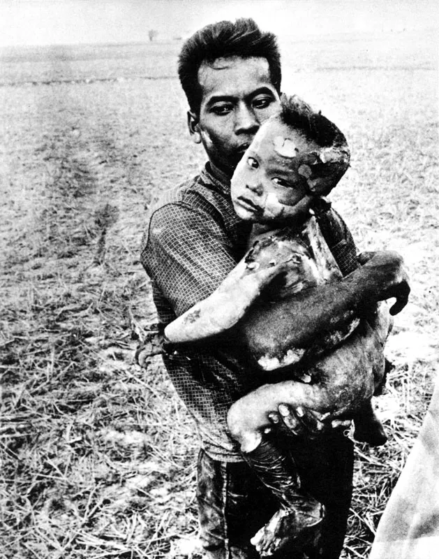 Un padre vietnamita sostiene a su hijo, que ha sido quemado con bombas de Napa1m. (Horot Faso, 1964).