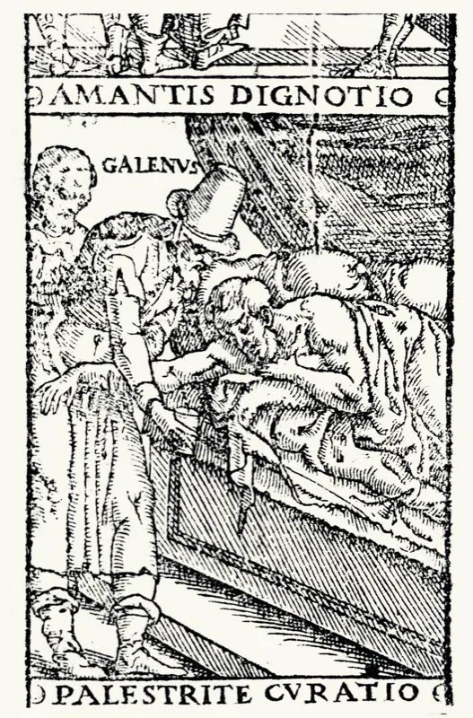 La sangría, al igual que la lavativa, eran los principales recursos médicos de la época colonial.